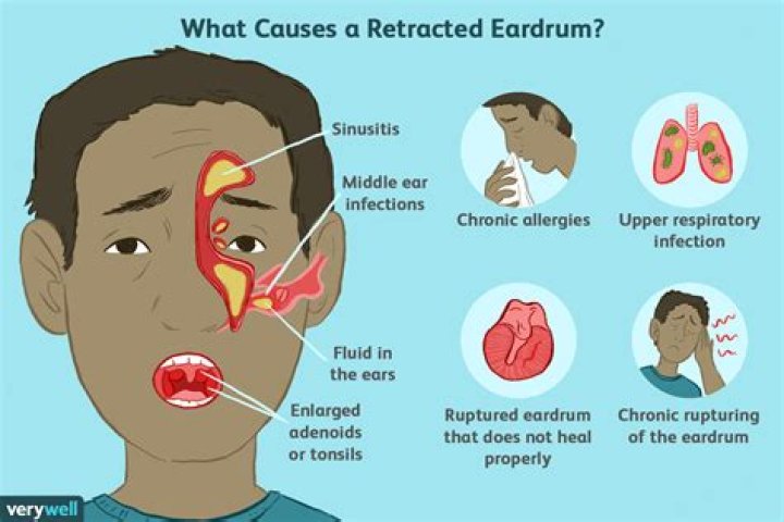 Can something get lost in your ear?