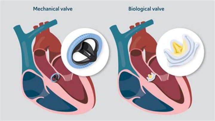 How long can AVR last?