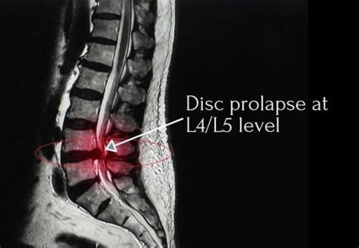 Is it a disc or player problem?