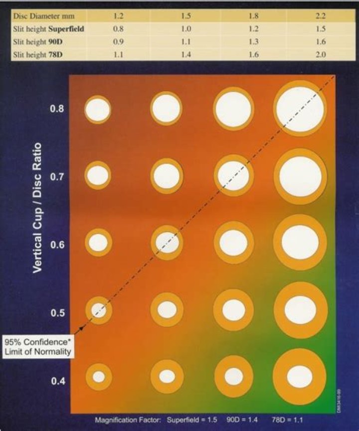 What are the 3 CD formats?