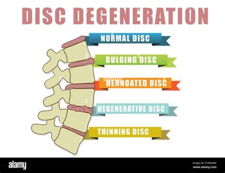 What does disc error mean?