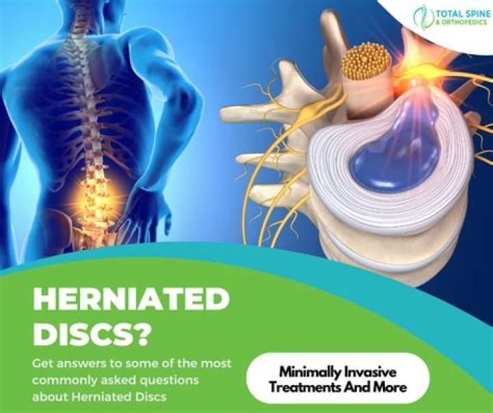 What should you not do with a herniated disc?