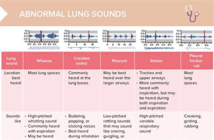 Why does system sounds keep going to 100?